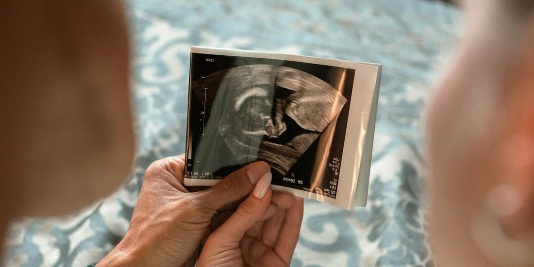 Ultrasound jewelry for bereaved moms